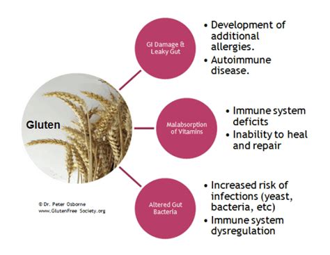 Novel association of gluten sensitivity with immune.